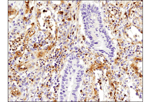 Immunohistochemistry Image 4: VISTA (D1L2G) Rabbit Monoclonal Antibody (BSA and Azide Free)