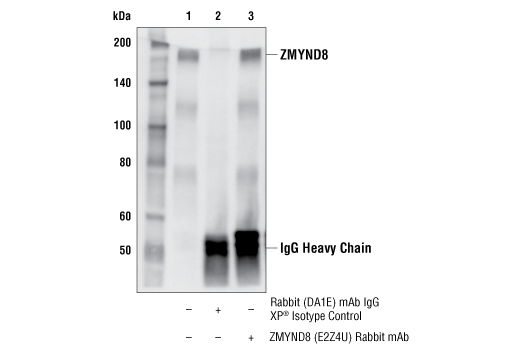 Immunoprecipitation Image 1: ZMYND8 (E2Z4U) Rabbit Monoclonal Antibody