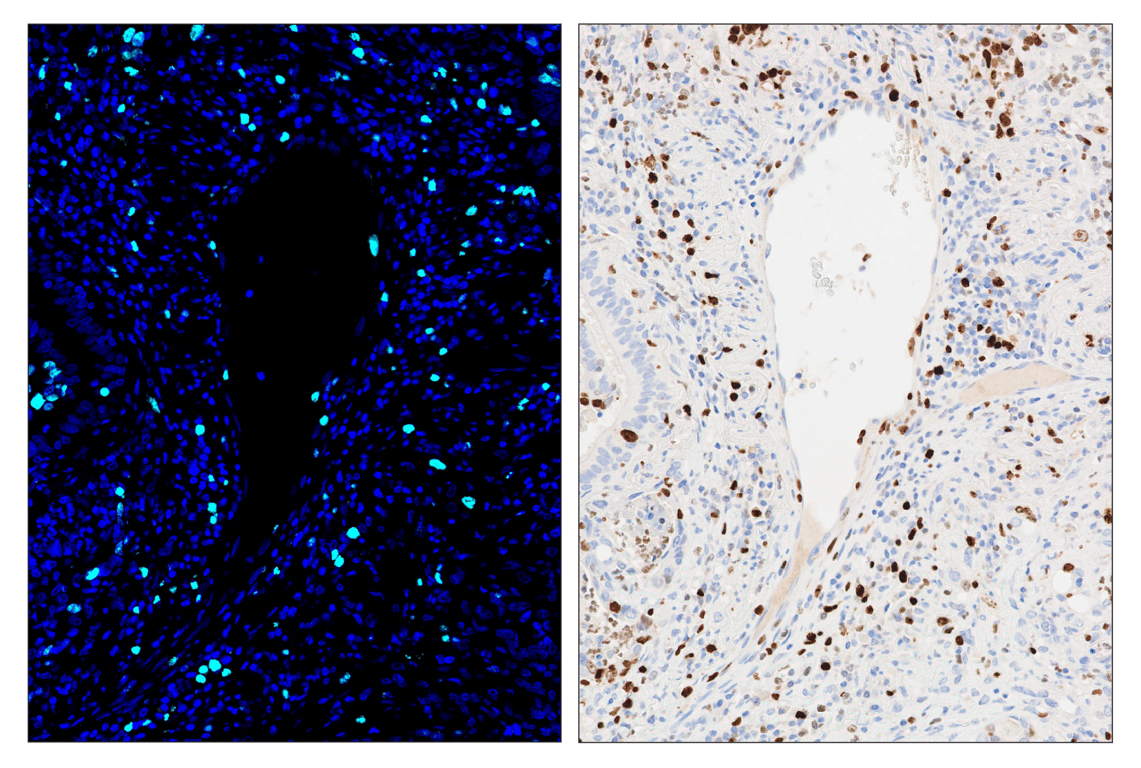 undefined Image 1: SignalStar<sup>™</sup> Midplex IHC Buffer Kit