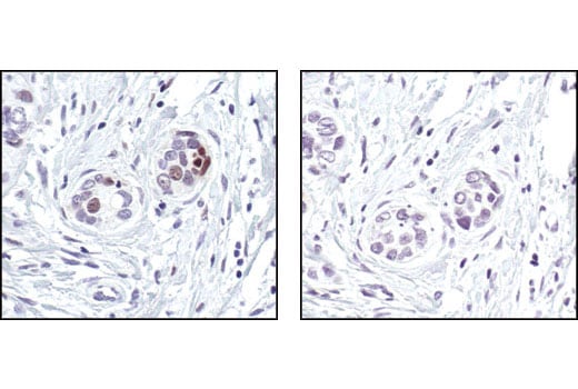 Immunohistochemistry Image 2: FosB (5G4) Rabbit mAb