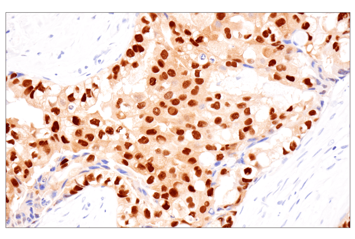 Immunohistochemistry Image 4: Estrogen Receptor alpha (D8H8) Rabbit Monoclonal Antibody