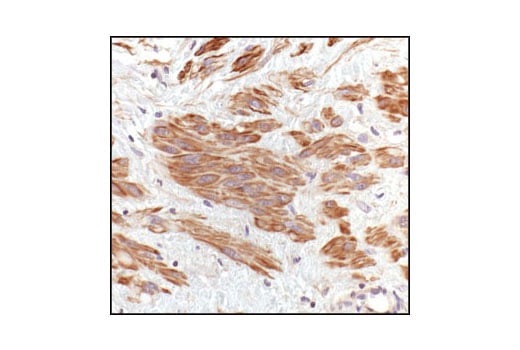 Immunohistochemistry Image 4: Pan-Actin Antibody