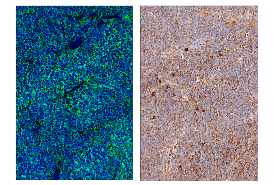 Immunohistochemistry Image 6: CD20 (E3N7O) & CO-0134-594 SignalStar<sup>™</sup> Oligo-Antibody Pair