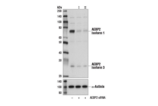 undefined Image 15: Polycomb Group 2 (PRC2) Antibody Sampler Kit