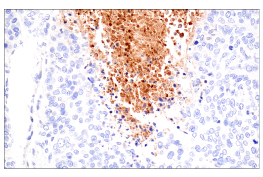 Immunohistochemistry Image 4: TIMP1 (D10E6) Rabbit Monoclonal Antibody