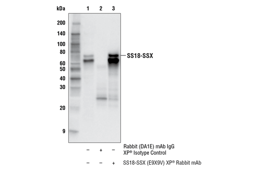 Immunoprecipitation Image 1: SS18-SSX (E9X9V) Rabbit Monoclonal Antibody
