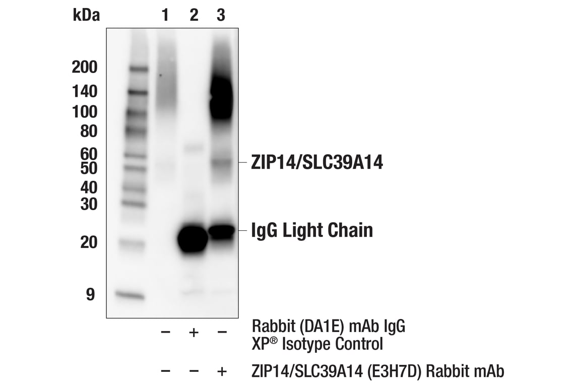 Immunoprecipitation Image 1: ZIP14/SLC39A14 (E3H7D) Rabbit Monoclonal Antibody