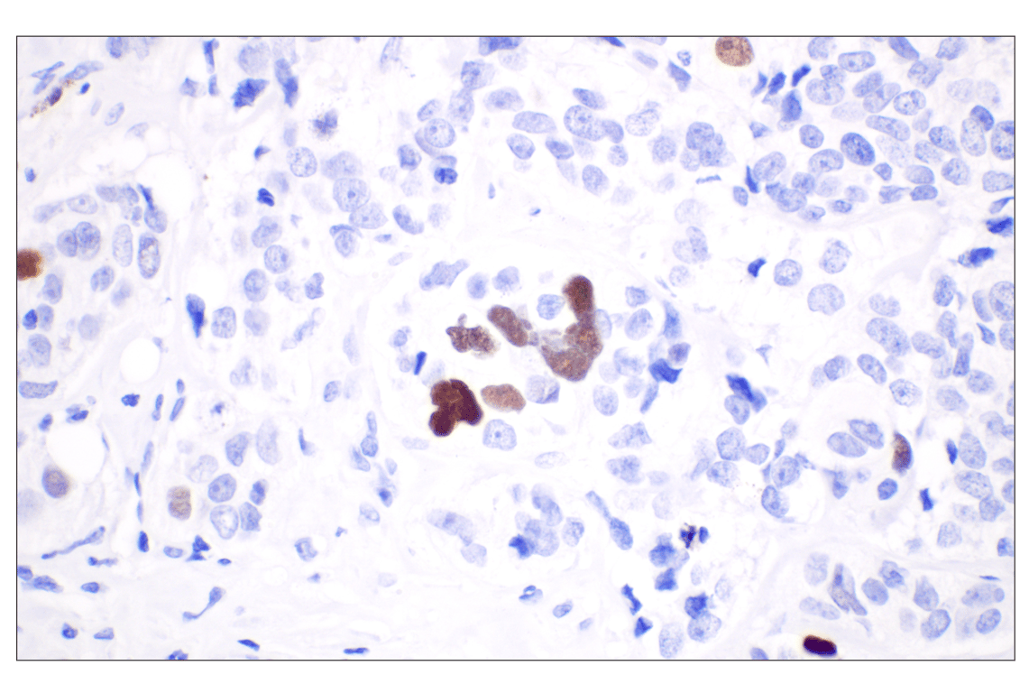 undefined Image 3: PhosphoPlus<sup>®</sup> DNA-PKcs (Ser2056) Antibody Duet
