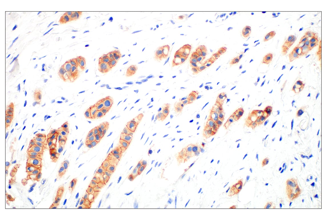Immunohistochemistry Image 1: HER3/ErbB3 (D22C5) Rabbit Monoclonal Antibody (BSA and Azide Free)