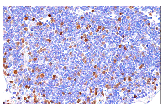 Immunohistochemistry Image 2: Cyclin A2 (E6D1J) XP<sup>®</sup> Rabbit mAb (BSA and Azide Free)