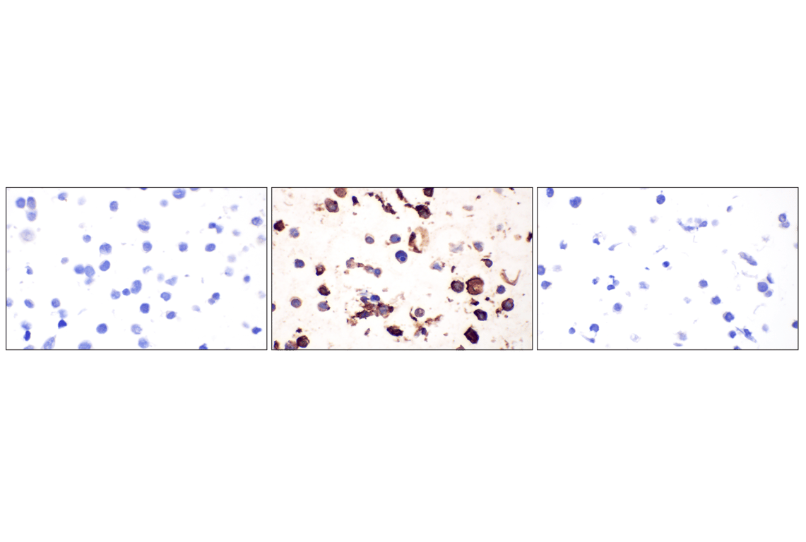 Immunohistochemistry Image 9: CD44 v6 (C44Mab-9) Mouse Monoclonal Antibody