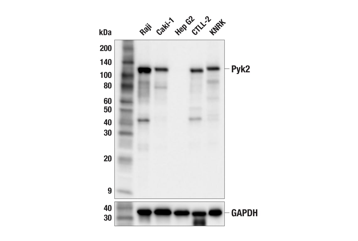 Western Blotting Image 2: Pyk2 (F3I2K) Rabbit Monoclonal Antibody