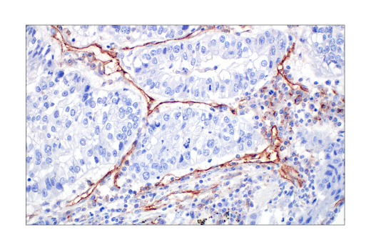 Immunohistochemistry Image 3: CD31 (PECAM-1) (89C2) Mouse Monoclonal Antibody (BSA and Azide Free)