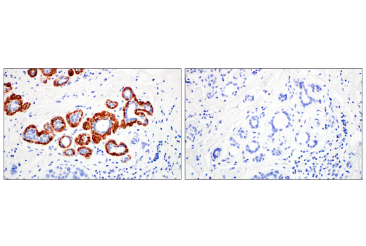 Immunohistochemistry Image 1: Keratin 14 (LL002) Mouse Monoclonal Antibody