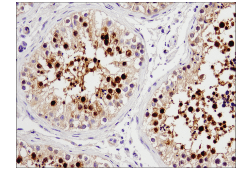 Immunohistochemistry Image 4: STK33 (D3S4R) Rabbit Monoclonal Antibody
