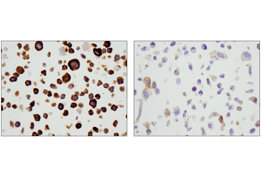 Immunohistochemistry Image 4: Legumain (D6S4H) Rabbit Monoclonal Antibody (BSA and Azide Free)