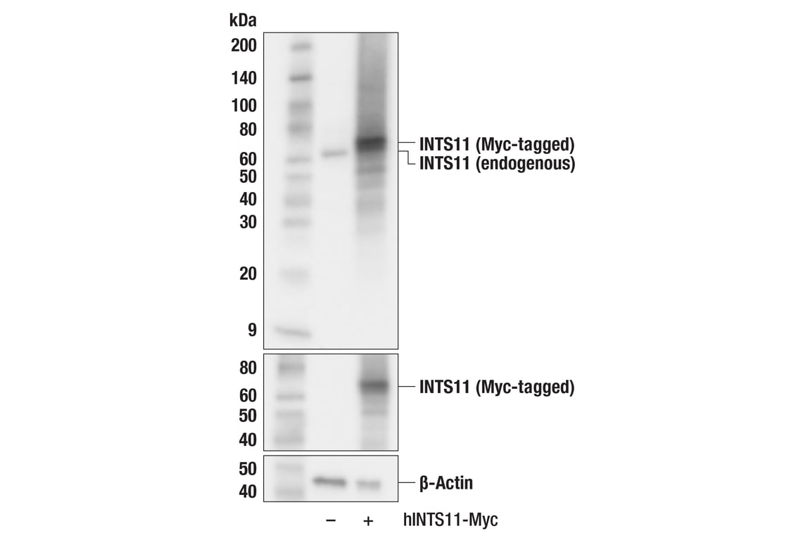 cstページ INTS11 (F2P6Z) Rabbit Monoclonal Antibody | Cell Signaling Technology