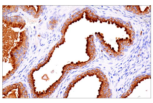 Immunohistochemistry Image 1: Rab27B (E4V3O) Rabbit Monoclonal Antibody