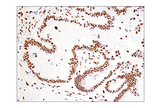 Immunohistochemistry Image 7: Phospho-ATF-2 (Thr71)/ATF-7 (Thr53) (E4A5G) Rabbit Monoclonal Antibody
