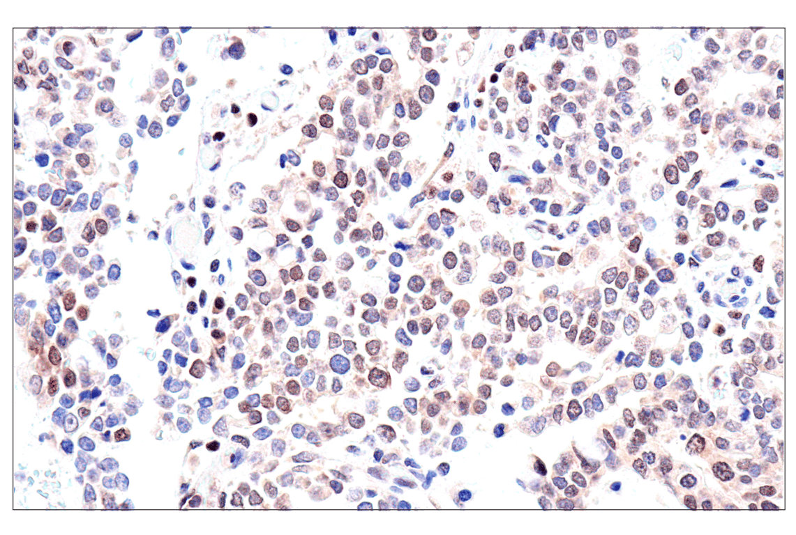 Immunohistochemistry Image 6: ADAR1 p150 Isoform (E6U1U) Rabbit Monoclonal Antibody (BSA and Azide Free)