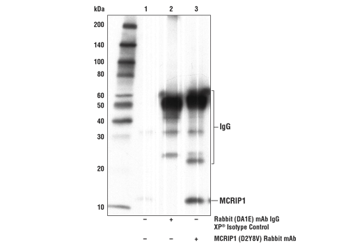 Immunoprecipitation Image 1: MCRIP1 (D2Y8V) Rabbit Monoclonal Antibody