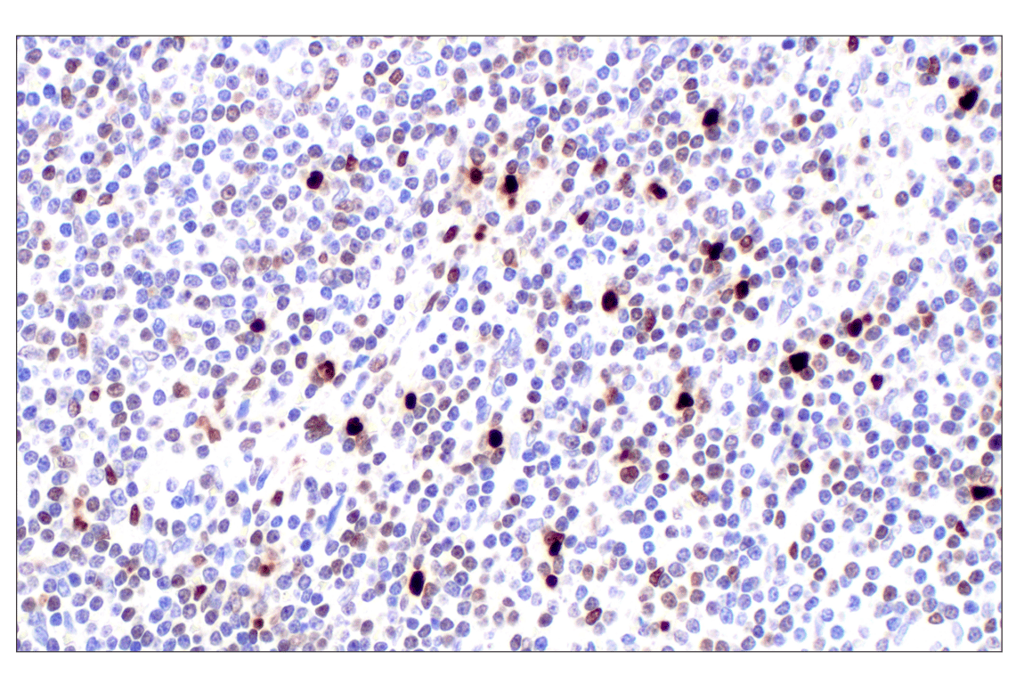 Immunohistochemistry Image 1: MNDA (3C1) Rat Monoclonal Antibody
