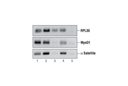 Chromatin Immunoprecipitation Image 2: SimpleChIP<sup>®</sup> Enzymatic Chromatin IP Kit (Agarose Beads)