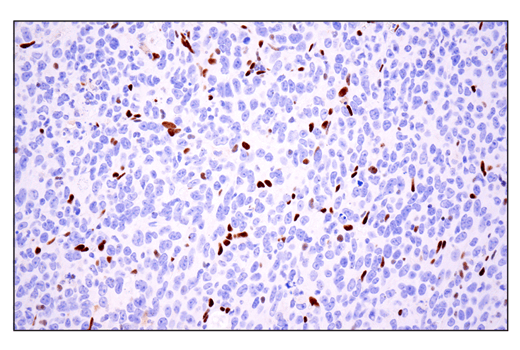 Immunohistochemistry Image 8: ZEB1 (E2G6Y) Rabbit Monoclonal Antibody (BSA and Azide Free)