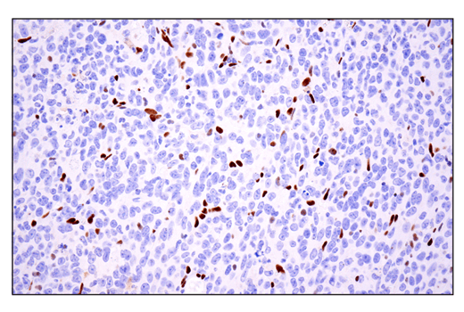 Immunohistochemistry Image 8: ZEB1 (E2G6Y) XP<sup>®</sup> Rabbit mAb (BSA and Azide Free)