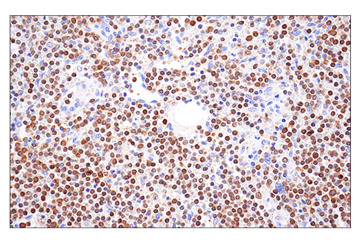 Immunohistochemistry Image 5: HPK1 (E1C3L) Rabbit Monoclonal Antibody