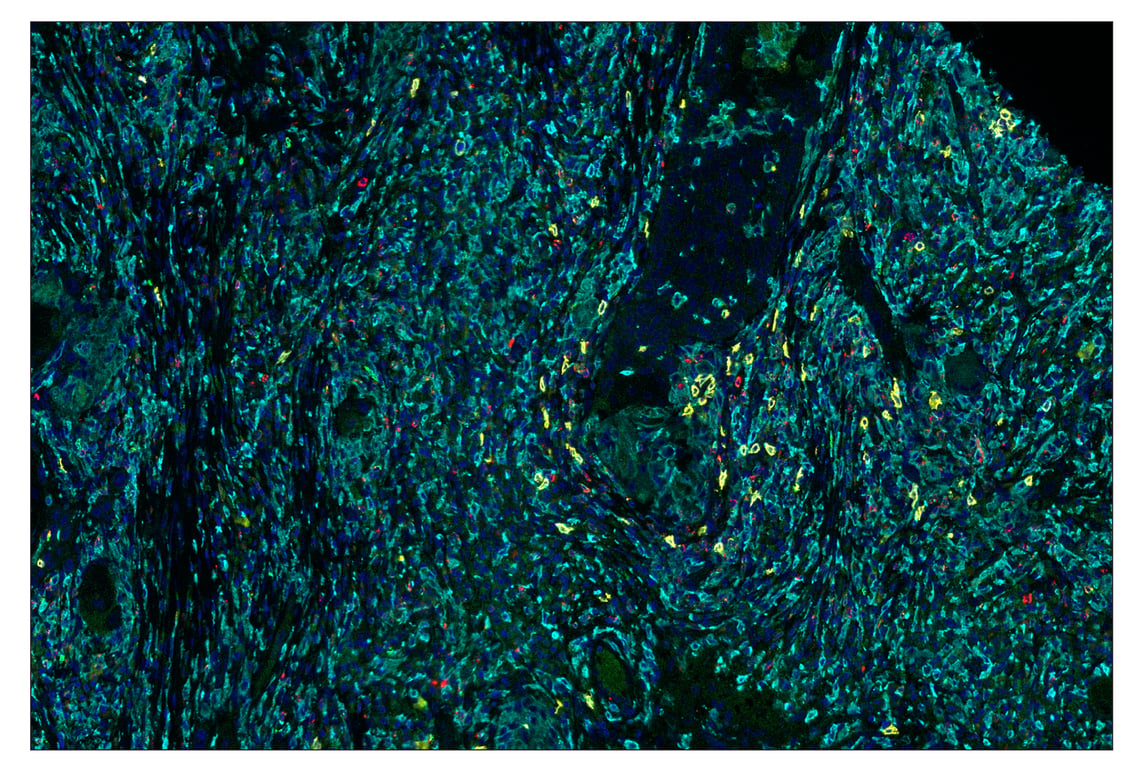 Immunohistochemistry Image 7: Granzyme B (D6E9W) & CO-0009-647 SignalStar<sup>™</sup> Oligo-Antibody Pair