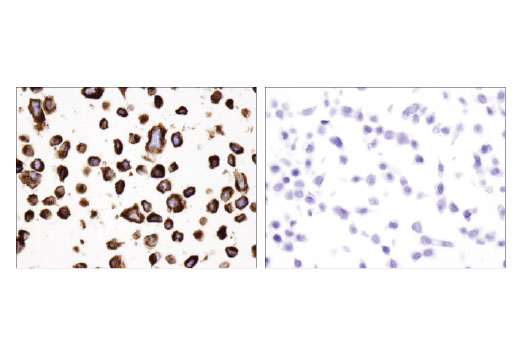 Immunohistochemistry Image 1: Bcl-2 (124) Mouse Monoclonal Antibody