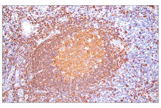 Immunohistochemistry Image 5: CD20 (E7B7T) Rabbit Monoclonal Antibody (BSA and Azide Free)