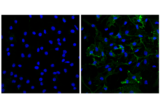 Immunofluorescence Image 1: CD38 (E9F5A) Rabbit Monoclonal Antibody (BSA and Azide Free)
