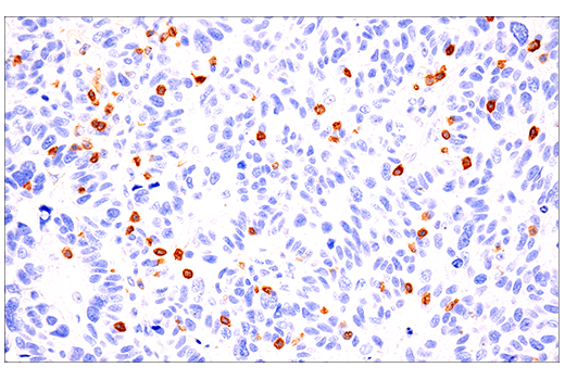 Immunohistochemistry Image 2: CD103/ITGAE (EP206) Rabbit Monoclonal Antibody