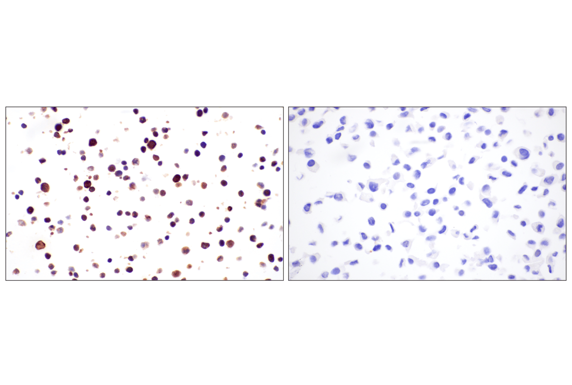 Immunohistochemistry Image 8: Eosinophil cationic protein (F3G7N) Rabbit Monoclonal Antibody (BSA and Azide Free)