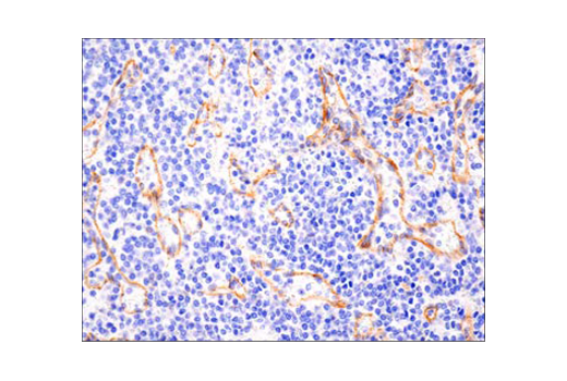 undefined Image 14: Epithelial-Mesenchymal Transition (EMT) Antibody Sampler Kit