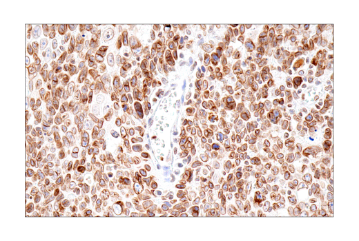 Immunohistochemistry Image 4: Lamin B1 (E6M5T) Rabbit Monoclonal Antibody