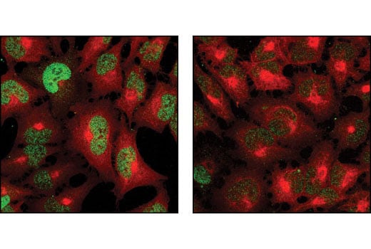 Immunofluorescence Image 1: Phospho-Stat5 (Tyr694) (C71E5) Rabbit Monoclonal Antibody
