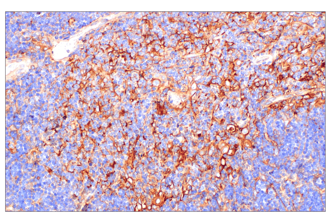Immunohistochemistry Image 1: beta2-microglobulin (F4S6H) Rabbit Monoclonal Antibody