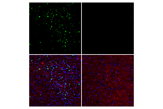 Immunofluorescence Image 1: Phospho-c-Fos (Ser32) (D82C12) Rabbit Monoclonal Antibody