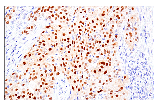 Immunohistochemistry Image 2: MAGE-A10 (E9V2Q) Rabbit Monoclonal Antibody (BSA and Azide Free)