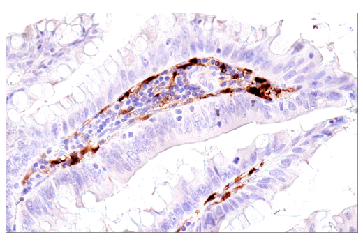 Immunohistochemistry Image 3: S100B (E7C3A) Rabbit Monoclonal Antibody (BSA and Azide Free)