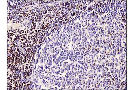 Immunohistochemistry Image 3: PKC theta (E1I7Y) Rabbit Monoclonal Antibody