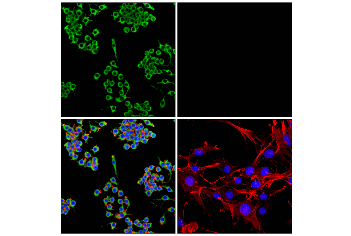 Immunofluorescence Image 1: HEXB (E9X5S) Rabbit Monoclonal Antibody (BSA and Azide Free)
