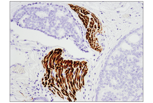 Immunohistochemistry Image 6: NCAM-L1 (D5D3K) Rabbit Monoclonal Antibody
