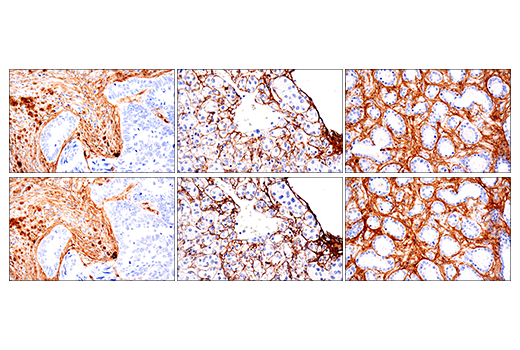 Immunohistochemistry Image 8: COL1A1 (E3E1X) Mouse Monoclonal Antibody