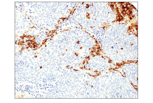 Immunohistochemistry Image 1: CD48 (D7L8I) Rabbit Monoclonal Antibody