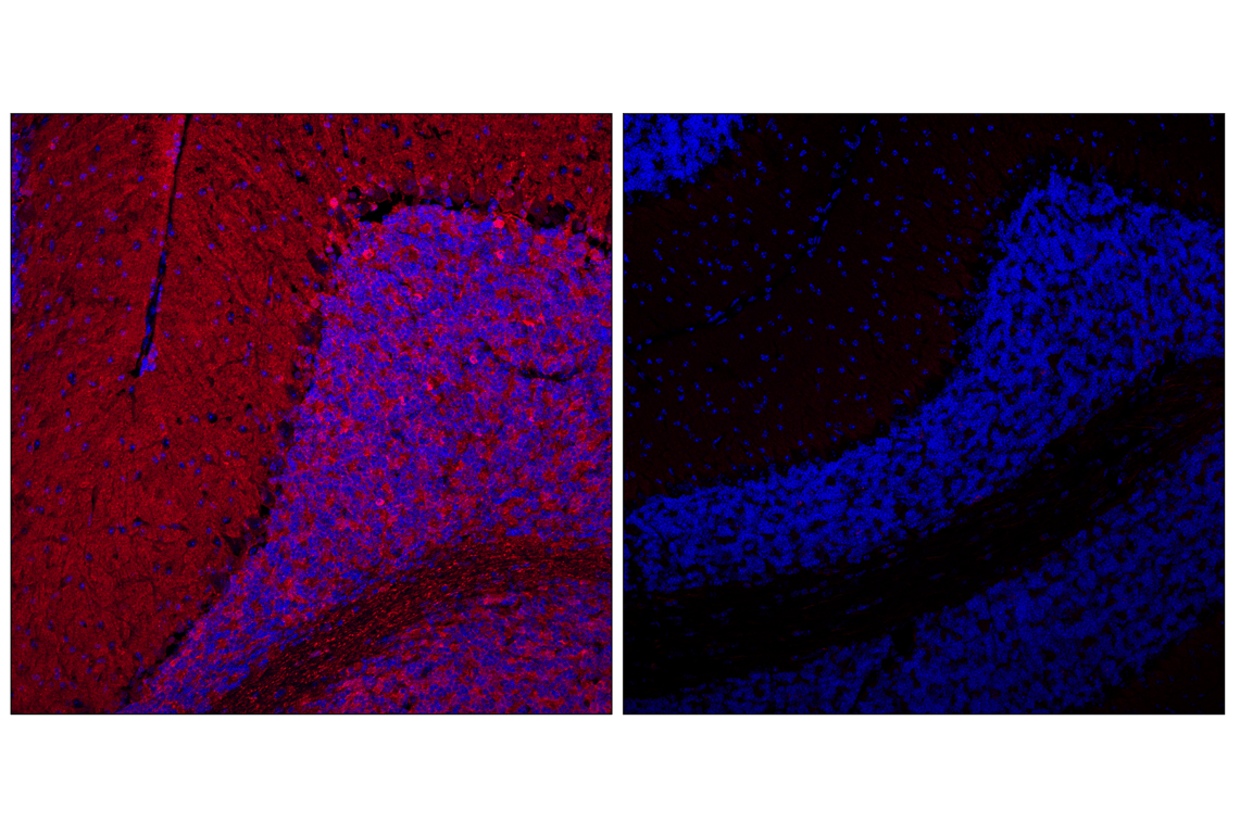 Immunofluorescence Image 1: Phospho-Tau (Ser202) (F2A2F) Rabbit Monoclonal Antibody