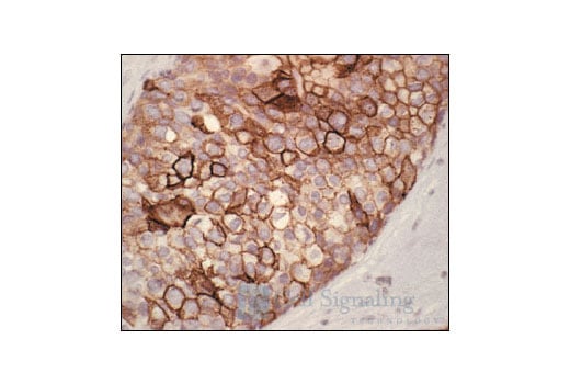 Immunohistochemistry Image 1: Phospho-EGF Receptor (Tyr1068) Antibody